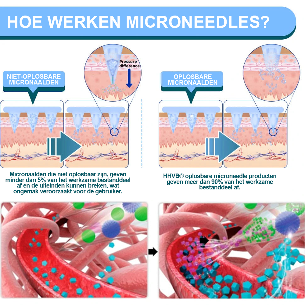 【Laatste dag promotie: 70% KORTING👩⚕️】𝐇𝑯𝑽𝐁® Nano Microneedle Patch 👨⚕️(Geen pijn, 24/7 afgifte | Verlies 10 kg SNEL | 90% suikerverlaging | )